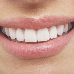 Closeup of beautiful smile after teeth whitening in Assonet