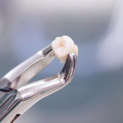 Clasp holding extracted tooth