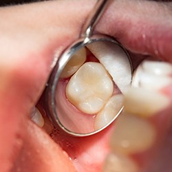 Woman getting dental treatment