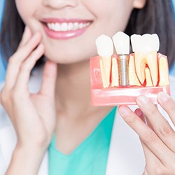 Dental implant dentist holding a model of a dental implant in the jaw