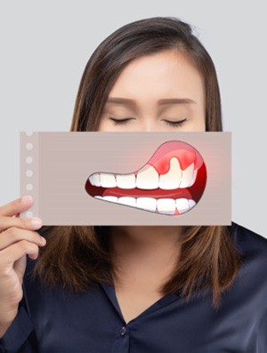 Woman holding image of swollen gums in front of her face