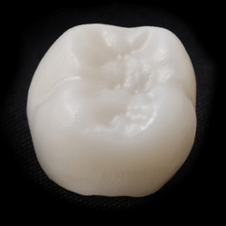 Metal free dental crown prior to placement