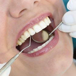 Dentist looking in patient’s mouth after porcelain veneer treatment