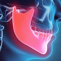 Animation of jaw and skull bone connection before T M J therapy