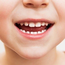 Closeup of child's healthy smile during children's dentistry treatment