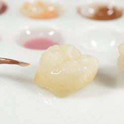 Tooth colored dental crown prior to placement