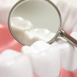 Closeup of tooth after tooth colored filling treatment