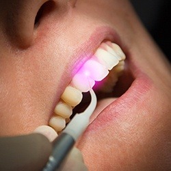 Patient receiving soft tissue laser dentistry treatment