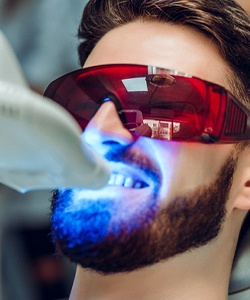 Closeup of man getting in-office teeth whitening in Assonet